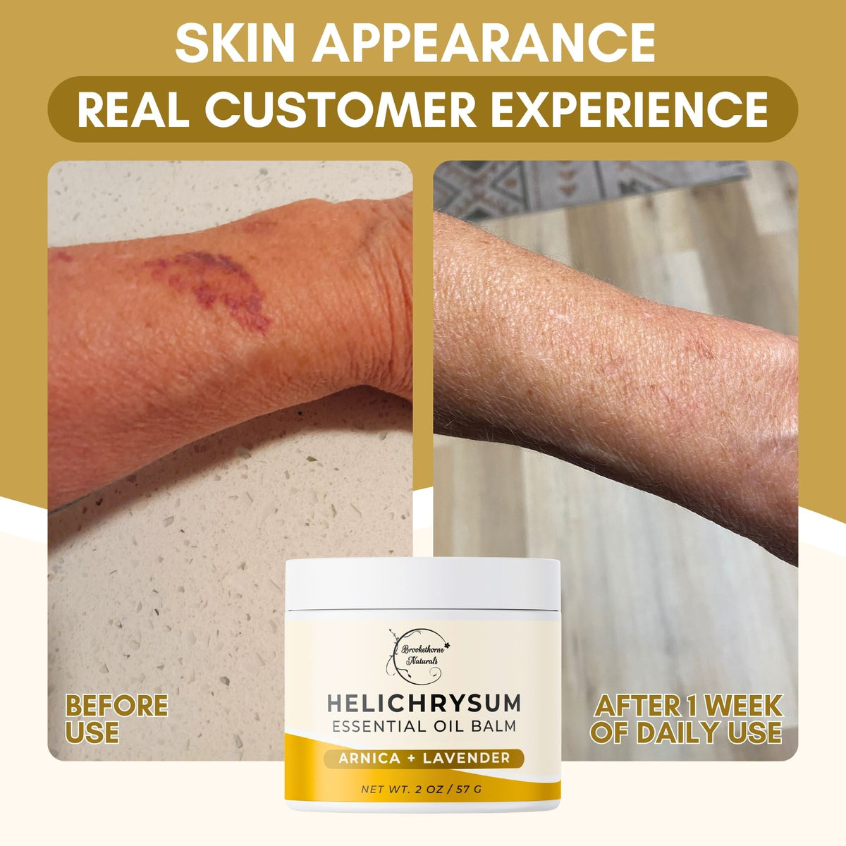 Helichrysum Balm