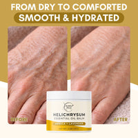 Helichrysum Balm