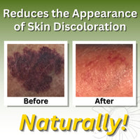 Arnica Massage Oil